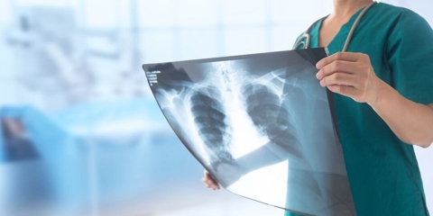 nurse holding up a chest xray